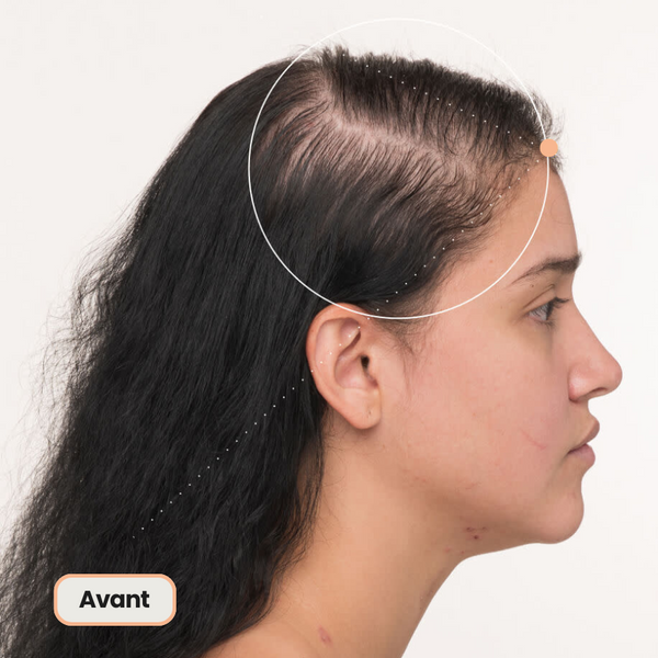 Shampoing solide pour accélérer la pousse