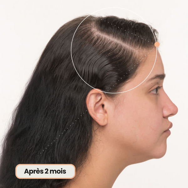 Shampoing solide pour repousse des cheveux